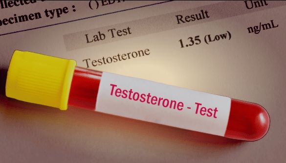 Low Testosterone Levels in Men and How to Improve