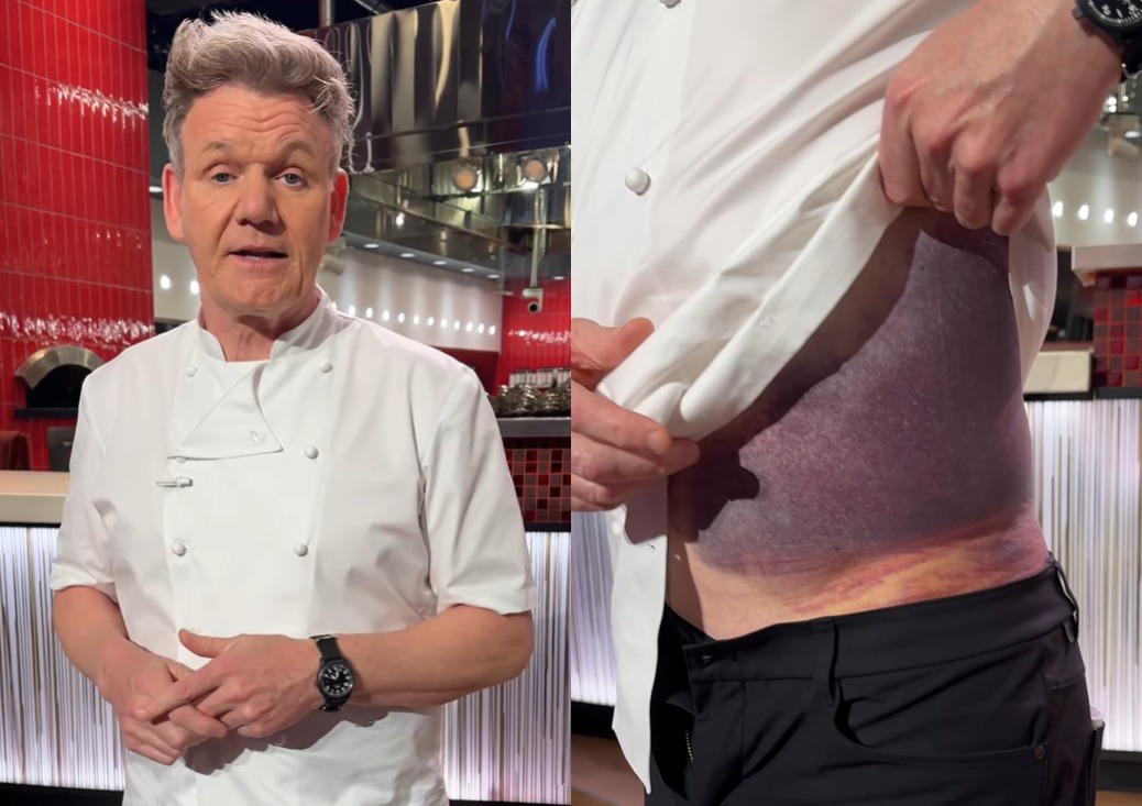 Helmet Saves the Life of Gordon Ramsay During an Accident 